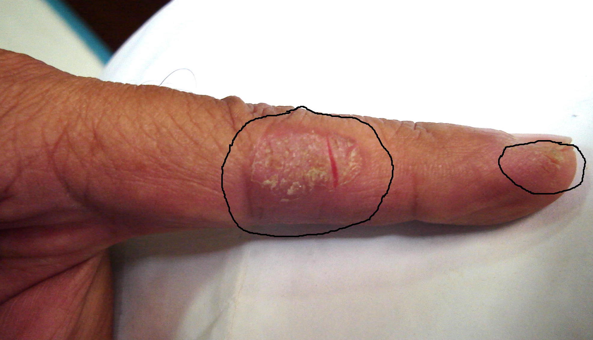 El tratamiento de la psoriasis en krasnodare los precios