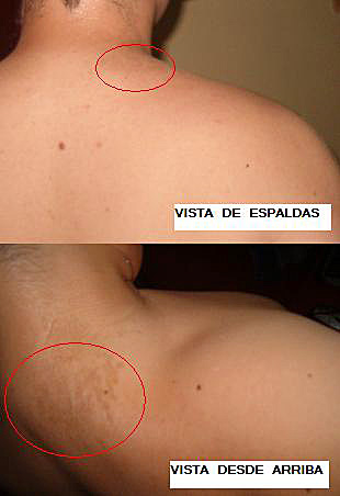 porque tengo manchas cafes linear unit solfa syllable espalda