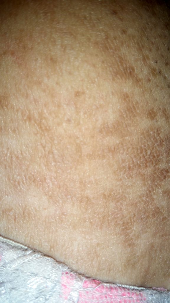 La cosmética de la depuración de la cutis
