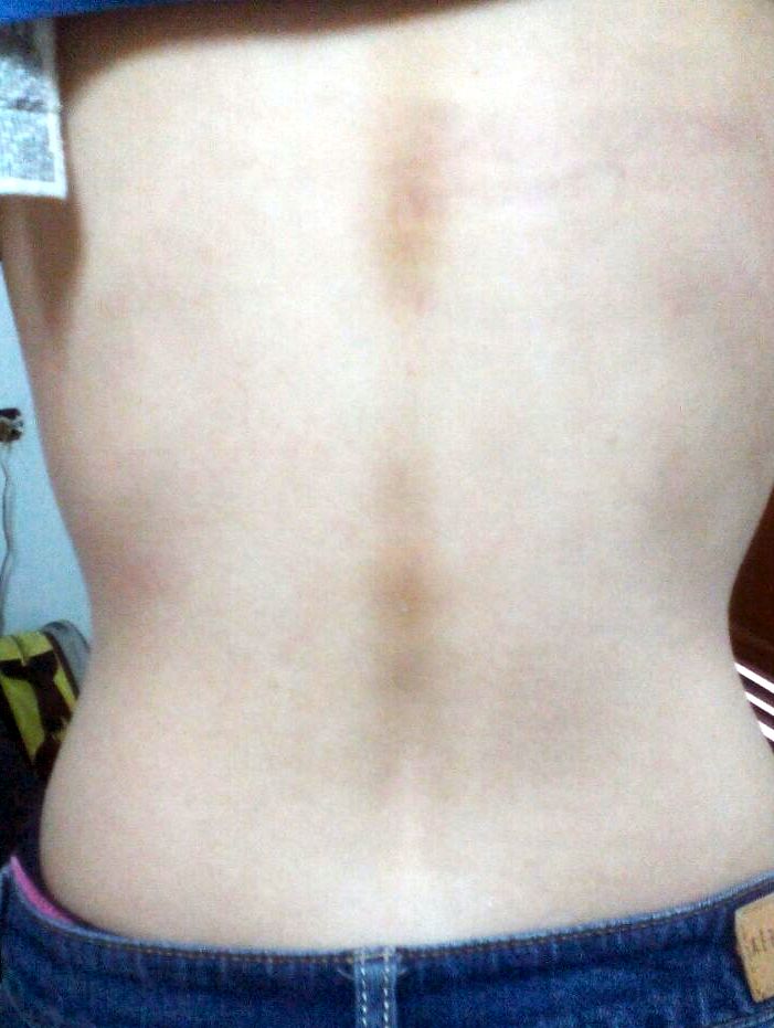 Los dolores que tiran en lo bajo del vientre y los riñones que esto